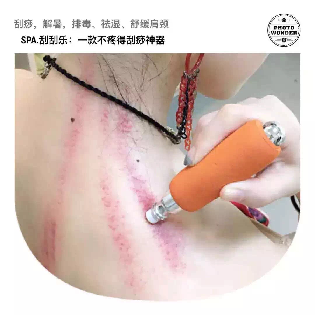 颈椎守护者 新型专利产品 空白市场