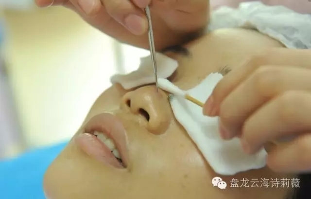 在对抗黑头问题上,诗莉薇很有一套!
