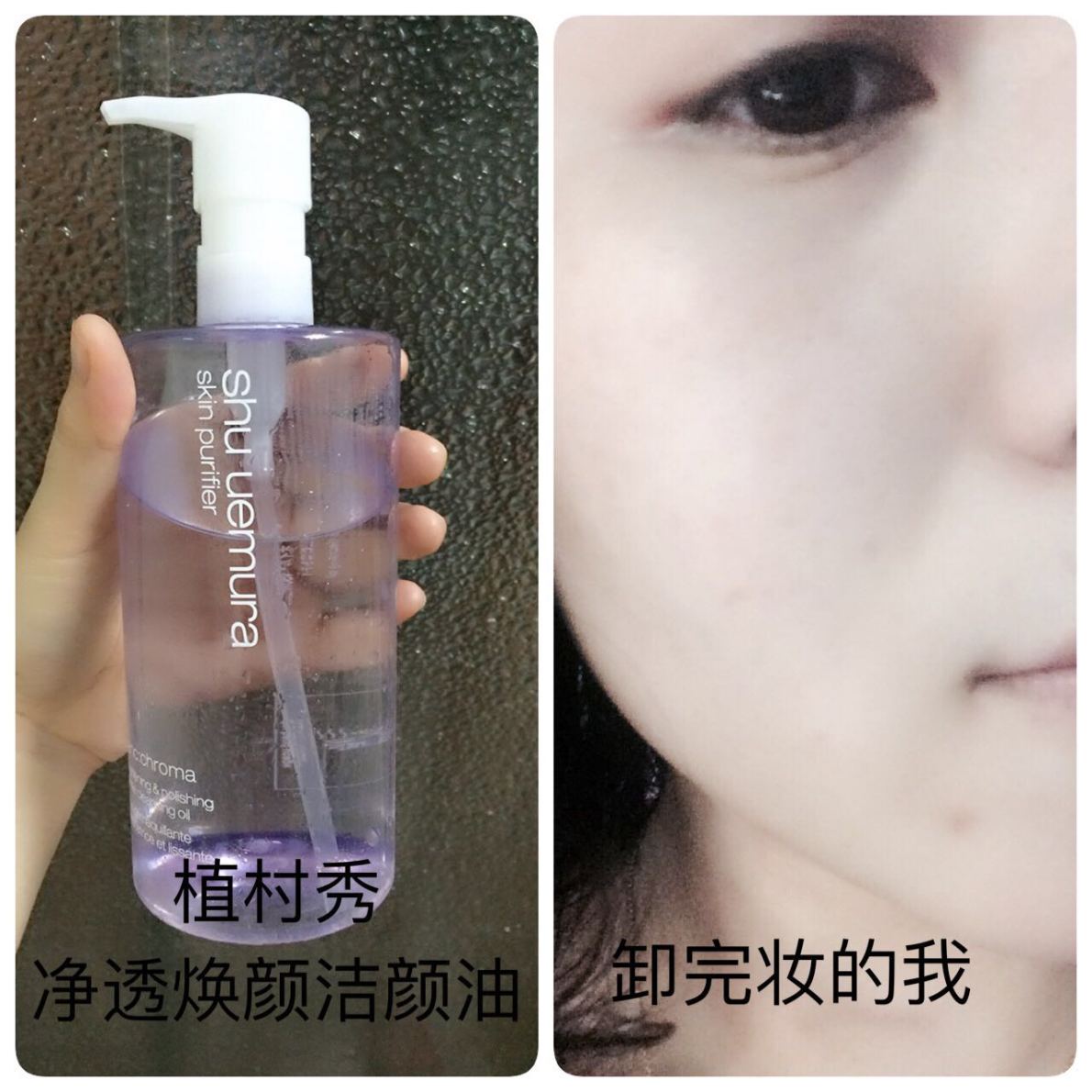 【我是shashatan】谈谈夏末初秋控油的问题
