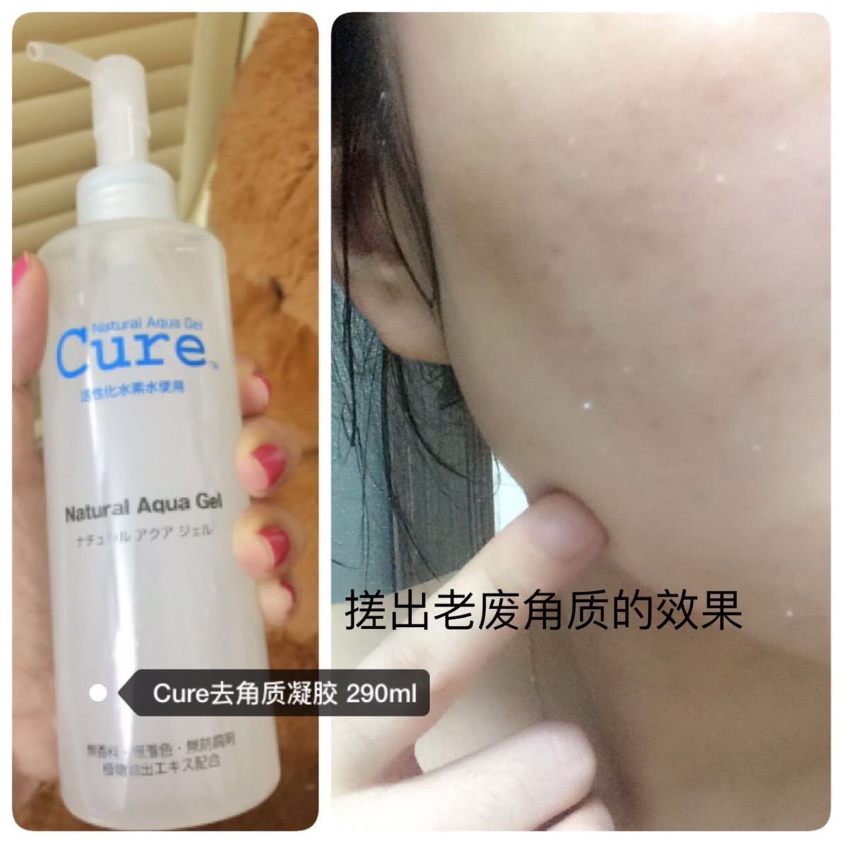 【我是shashatan】谈谈夏末初秋控油的问题